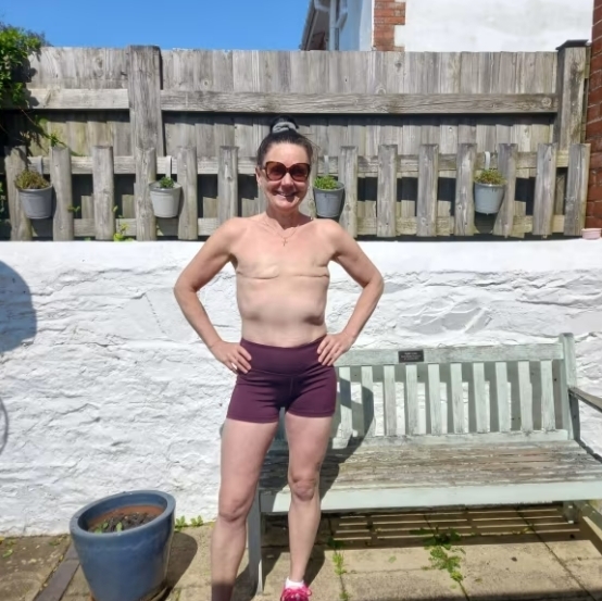 2022년 유방암으로 인해 양쪽 유방 절제술을 받은 영국의 로이스 부처는 유방암 및 유방절제에 대한 인식 제고를 위해 상의를 탈의하고 달리기를 연습하는 영상을 SNS에 업로드 해 왔다. 사진=인스타그램