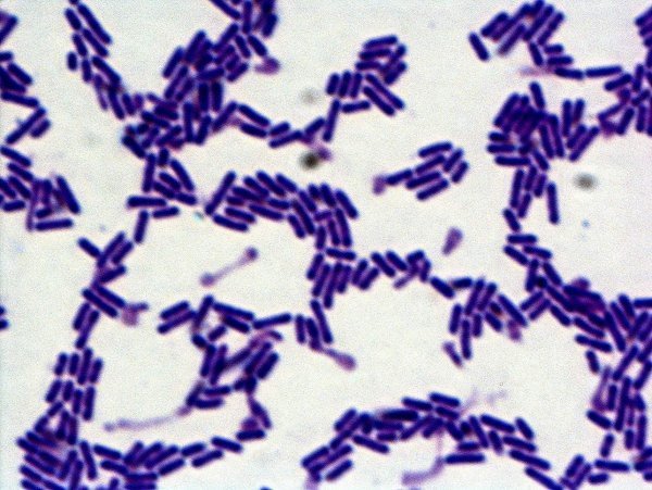 프로바이오틱스 유산균 ‘락토바실러스 카제이 HY2782’. hy 제공