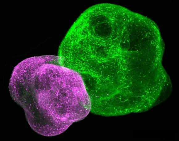 오가노이드는 줄기세포를 이용해 만드는 유사 미니 장기이고 어셈블로이드는 세포 재구성을 통해 조립형 미니 인공장기를 만드는 기술이다. 과학자들은 오가노이드와 어셈블로이드를 이용해 뇌의 각 부위가 다른 뇌 부위와 어떻게 연결되는지를 알 수 있다. 사진은 피질-선조체 어셈블로이드를 찍은 것.  미국 스탠퍼드대·스위스 EPFL 제공
