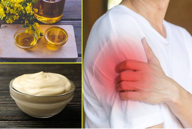 오메가-6가 풍부한 음식에는 카놀라유, 옥수수유, 마요네즈, 홍화유, 해바라기유, 땅콩 기름 등이 있다. 하지만 오메가 3가 부족하고 오메가 6가 너무 많으면 염증이 생기고 지속될 수 있다. [사진=게티이미지뱅크]