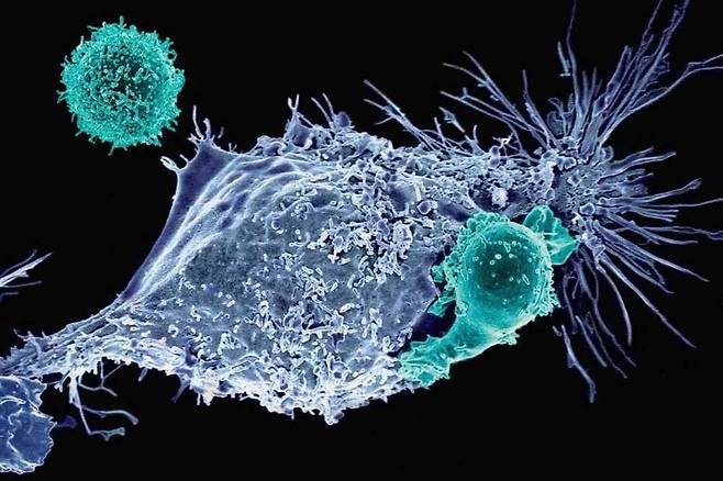 CAR-T세포(녹색)가 암세포(파란색)를 공격하는 모습./미 메모리얼 슬로언 케터링 암센터