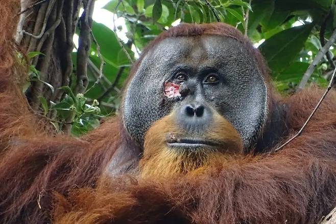 인도네시아의 보호구역에 사는 오랑우탄이 전통 약용식물로 ‘자가 치료’를 하는 모습이 최초로 발견됐다. 오른쪽 얼굴에 상처를 입은 수마트라오랑우탄 ‘라쿠스’의 모습. 이사벨 라우머/사이언티픽 리포트 제공