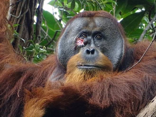 야생 오랑우탄이 식물로 즙을 만들어 상처 부위를 치료하는 모습이 포착됐다. 사진은 약초즙을 상처 부위에 바른 수컷 스마트라 오랑우탄 라쿠스의 모습. /사진=로이터