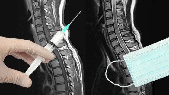 1억명에 가까운 사람을 조사한 결과 지금까지 드러나지 않았던 2가지의 새로운 부작용이 발견됐다. 사진 George Tackley