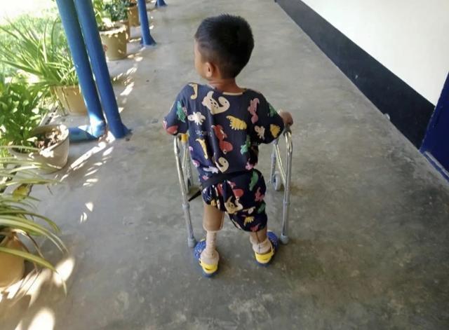 2022년 12월 미얀마 카렌주의 한 재활센터에서 3세 어린이가 의족 사용법을 배우고 있다. 소년은 같은 해 7월 지뢰에 왼쪽 다리를 잃었다. 카렌=AP 연합뉴스 자료사진