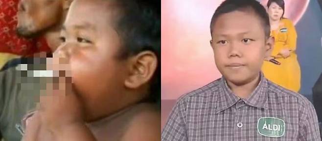 2살부터 하루에 40개비씩 줄담배를 피우던 알디의 근황이 공개됐다. 어린 시절 흡연하던 알디의 모습(왼쪽)과 16살이 된 현재 알디의 모습./사진=조선일보