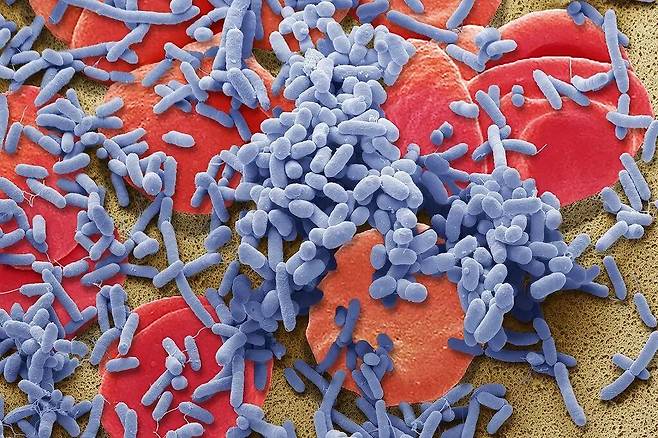 적혈구(붉은색)를 덮은 패혈증 박테리아. 이상 면역반응을 유발해 장기를 손상시킨다./Science Source