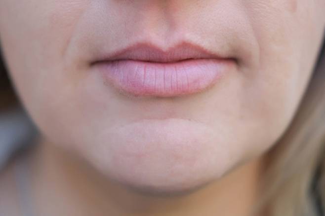 유독 인중, 배, 턱에 털이 많이 자라는 여성이라면, 다낭성 난소증후군을 의심해야 한다./사진=게티이미지뱅크