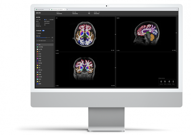 뉴로핏의 AI 기반 뇌질환 진단 보조 소프트웨어 '아쿠아'[사진제공=뉴로핏]