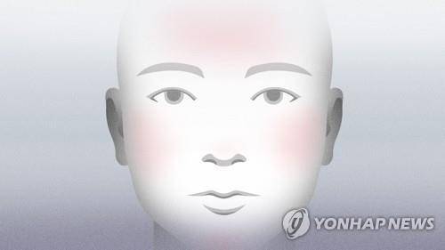 안면홍조 (PG) [강민지 제작] 일러스트