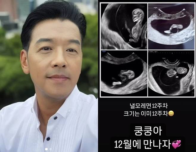 ▲ 류시원. 출처| 류시원 인스타그램