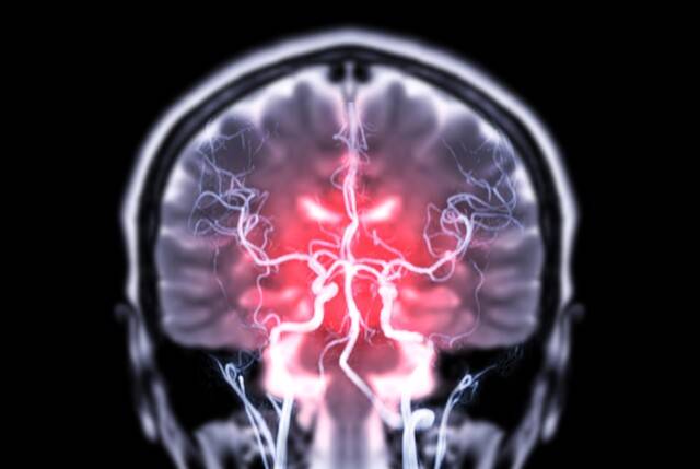 사진은 기사의 특정 내용과 관련 없음. 게티이미지뱅크