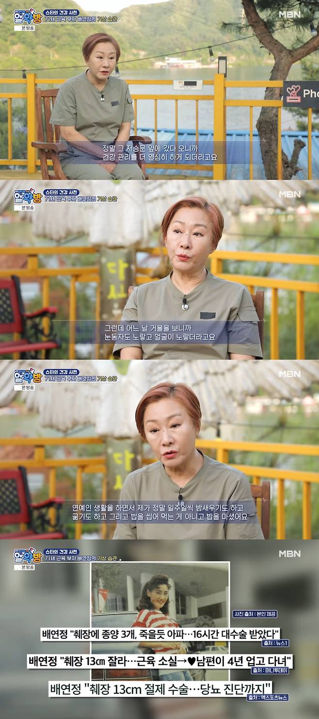 /사진=MBN '알약방' 방송 화면