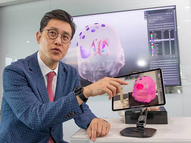 2일 오전 서울 종로구 메디컬아이피 사무실에서 박상준 대표가 수술 부위를 보여주는 증강현실 영상을 보여주고 있다. 뒤 모니터 화면에 두개골 영상에 내부 수술 부위가 같이 보인다. 인공지능으로 평면 MRI 영상을 3D로 구현했다./이태경 기자
