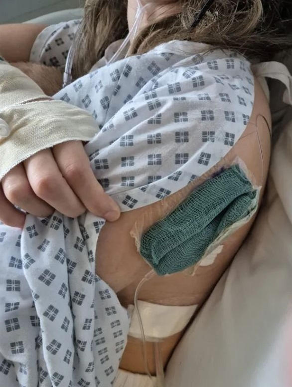 영국 에그레몬트 출신 카일라 블라이트(17)는 일주일에 액상 전자담배 4000개(연초 담배 400개 분량)를 피워 폐 일부를 제거했다. [사진 출처 = 영국 매체 더 선]