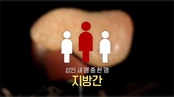 우리나라 지방간 환자 수는 매년 증가하는 추세이며, 성인 3명 중 1명이 가지고 있을 정도로 매우 흔한 질병이다. 그러나 지방간이 흔하다고 대수롭지 않게 넘겨서는 안 된다. [사진=EBS]