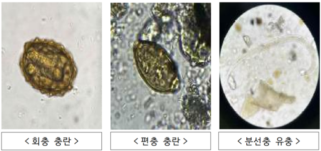 북한이 살포한 오물풍선 내 토양에서 발견된 기생충. 해당 토양에서 사람 유전자가 발견돼 인분에서 비롯됐을 가능성이 제기된다. /통일부 제공