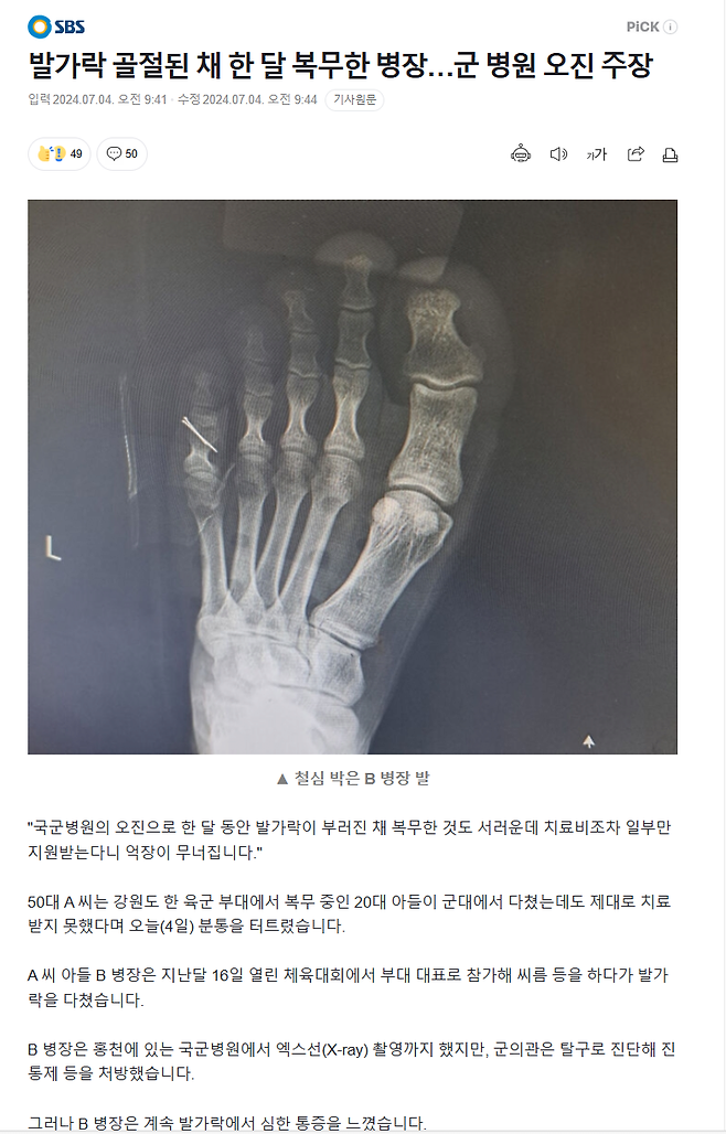 발가락 골절된 채 한 달 복무한 병장…군 병원 오진 주장