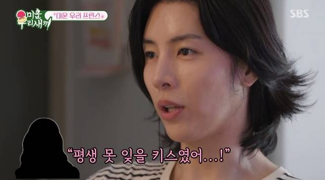 ‘미운우리새끼’ 이상민 성형 후기(사진: SBS)