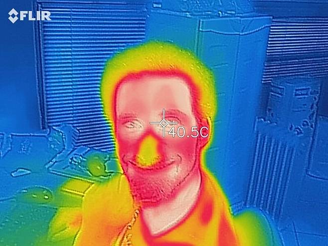 노화의 정도, 당뇨병이나 고혈압 같은 만성질환 유무에 따라 얼굴 부위별 온도가 달라지는 것으로 나타났다. 위키미디어 코먼스