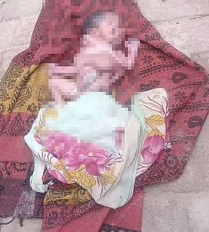 인도에서 얼굴 2개, 팔과 다리가 4개를 가진 아기가 태어났으나 5시간 만에 사망했다. (사진=데일리메일 캡처) *재판매 및 DB 금지