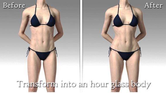 골반 성형 수술 전, 후 비교 예시도​./사진=건양대병원