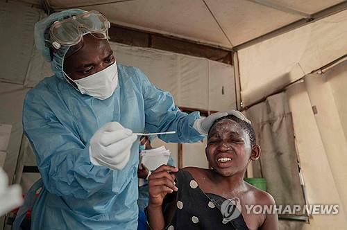 ▲ 17일(현지시간) 콩고민주공화국의 한 병원 엠폭스 치료센터에서 검사를 받는 환자 [AFP=연합뉴스]