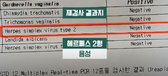 산부인과에서 '성병 오진'을 받아 남편과 이혼까지 생각했다는 결혼 20년차 이상 아내의 사연이 전해졌다. 사진은 여성 A씨가 다른 산부인과에서 재검진한 검사 결과. [사진=JTBC 사건반장 화면 캡처]