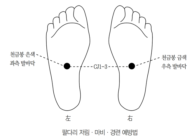 팔다리 저림·마비·경련 예방법. 고려수지침학회 제공