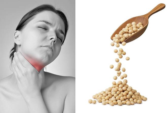 갑상선 질환을 관리할 때 특정 음식을 피해야 하는 특별한 이유가 있다. 일부 음식과 보충제가 갑상선 약물의 효과를 방해할 수 있기 때문이다. [사진= 게티이미지뱅크]