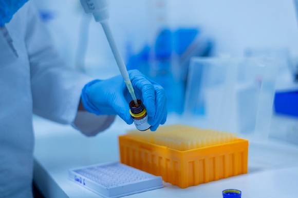 사진은 기사 내용과 무관함. [사진=픽사베이]