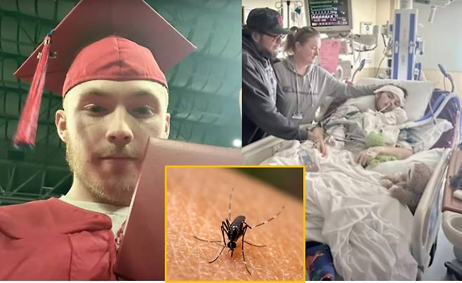 건강했던 10대 소년이 모기에 물린 후 몸을 움직일 수 없게 된 사연이 소개됐다. [사진=더선 보도 갈무리/ 아래사진=이집트숲모기, 게티이미지뱅크]