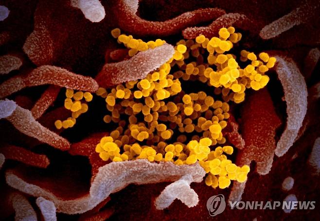 코로나19 바이러스 전자현미경 이미지 [EPA=연합뉴스 자료사진, National Institutes of Health (NIH) 제공. 재판매 및 DB 금지]