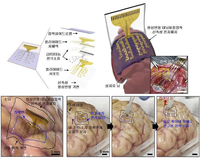 IBS와 KIST 공동 연구진이 만든 형상변형 대뇌피질접착 신축성 전자패치 개요와 실제 쥐의 뇌에 전자패치를 부착한 모습./IBS