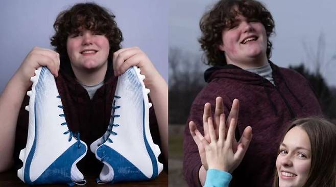 팔뚝 길이와 비슷한 킬번의 신발 사이즈(왼)과 한 여성과 손을 맞대, 손 크기를 비교하고 있는 킬번의 모습(오)/사진=뉴욕 포스트