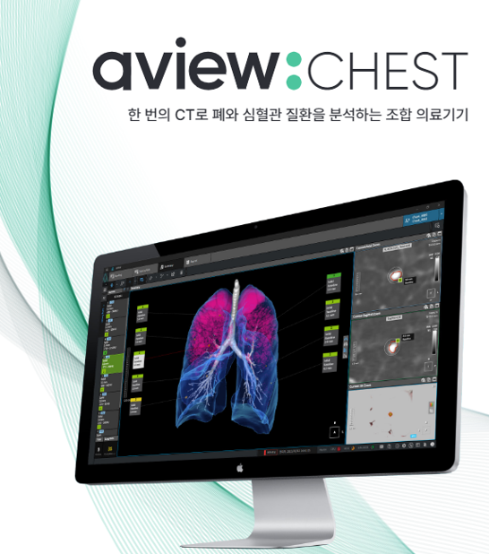 에이뷰 체스트./사진 제공=코어라인소프트