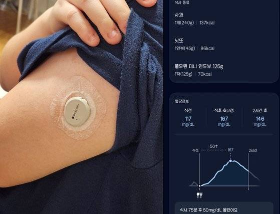 직장인 김모(32)씨가 연속혈당측정기(CGM)를 왼팔에 부착한 모습(왼쪽)과 이 센서에서 측정된 혈당 수치를 스마트폰 앱에 기록한 모습. 사진 김씨 제공