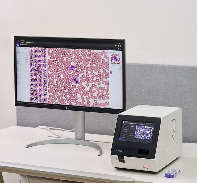 노을의 AI 기반 혈액 분석 솔루션(miLab™ BCM)은 형태학적으로 비정상적인 혈액 세포를 구별해 각 세포의 디지털 이미지를 제공한다. <사진 제공=노을>