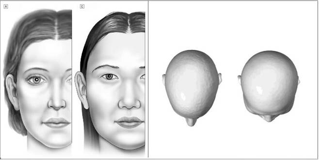 왼쪽 사진의 (A)는 평균적인 북미 백인 여성의 정면 모습, (C)는 평균적인 한국계 여성의 정면 모습입니다. 한국인의 얼굴은 좌우로 넓고 골격구조가 두드러져 상대적으로 처짐이 늦습니다. 오른쪽 사진에서는 왼쪽이 백인, 오른쪽이 동아시아인 두상입니다. 백인의 얼굴은 한국인에 비해 좌우 폭이 좁고 앞뒤 길이가 깁니다. [사진=Applied Ergonomics 41 (2010) 832–839]