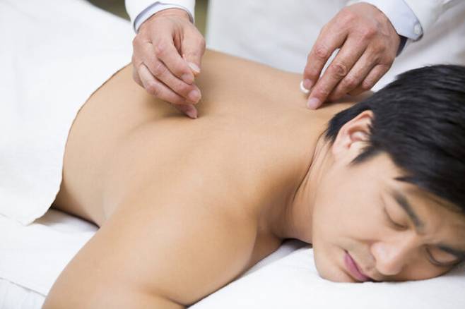 침술이 좌골신경통에 효과가 있다는 연구 결과가 나왔다. 위 사진은 기사와 직접적인 관계없음. [사진=게티이미지뱅크]