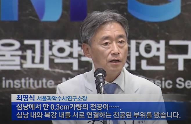 최영식 서울과학수사연구소장이 신해철씨의 부검 결과를 발표하고 있는 모습./사진=KBS 뉴스 갈무리