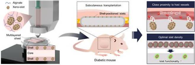 피하 췌도 이식의 개념도. UNIST 제공