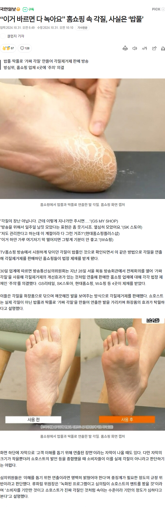 33.png “이거 바르면 다 녹아요” 홈쇼핑 속 각질, 사실은 ‘밥풀’