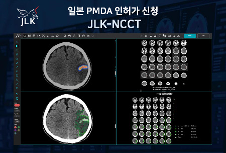 제이엘케이가 뇌졸중 AI 솔루션 ‘JLK-NCCT’의 일본 PMDA 신청을 완료했다./사진=제이엘케이