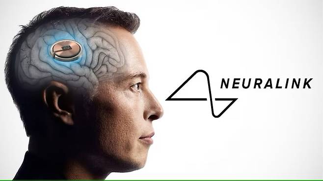 일론 머스크 테슬라 최고경영자(CEO)가 이끄는 뇌신경과학 스타트업 뉴럴링크(Neuralink)가 미 식품의약국(FDA) 허가를 받고 인간의 뇌에 칩을 이식하는 임상시험을 진행했다./Neuralink