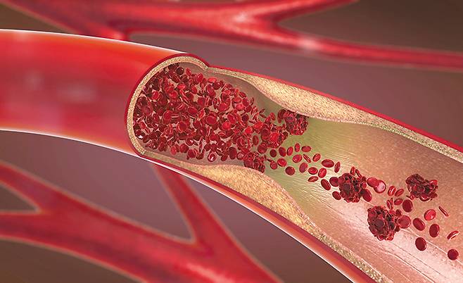 클립아트코리아