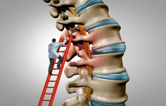 척추에는 다양한 질환이 발생할 수 있으며, 이를 정확히 진단하는 것이 중요하다 ｜출처: 게티이미지뱅크