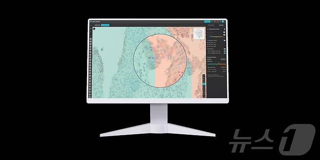 루닛 스코프 uIHC 활용 모습.(루닛 제공)/뉴스1 ⓒ News1