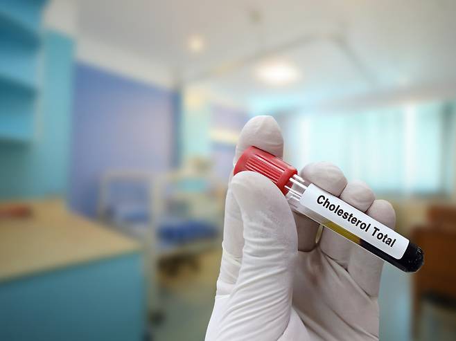콜레스테롤은 세포막의 생성과 유지에 필수이고 쓸개즙, 비타민D 등의 '원료'이기도 하다. 문제는 지나치게 많을 때 심혈관 건강에 나쁜 영향을 미친다는 것이다. [사진=게티이미지뱅크]