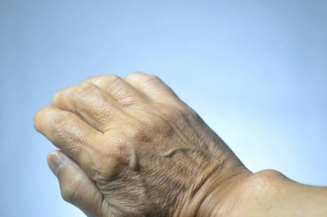 피는 붉은데 정맥은 파랗게 보이는 건 빛의 산란 때문이다. 피의 색은 붉지만 산소함유량에 따라 색조가 변한다. [사진=게티이미지뱅크]